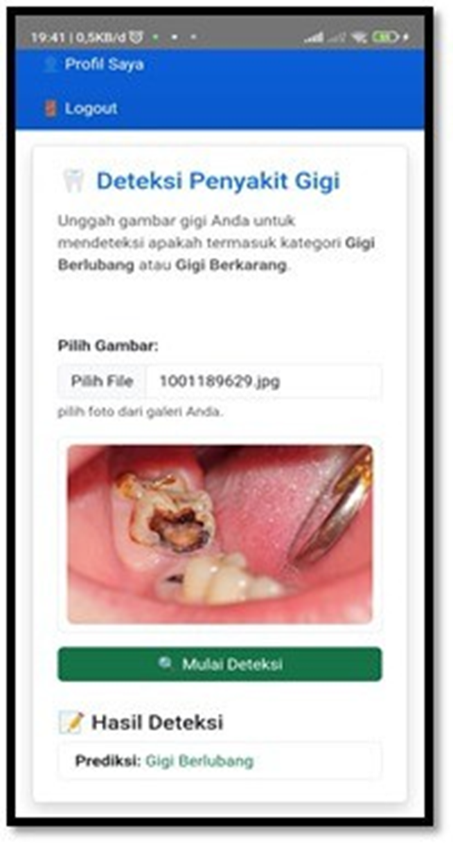Dental Disease Detection App